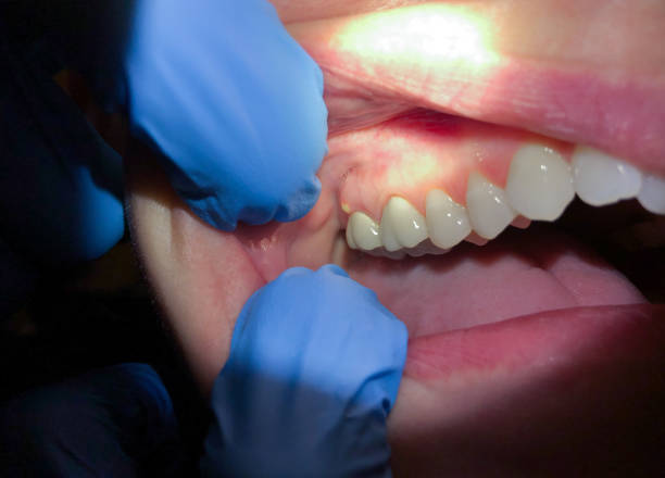 Best Emergency Cosmetic Dentistry (e.g., broken veneers) in Central Falls, RI
